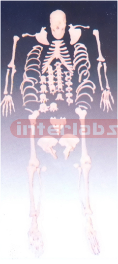 Disarticulated skeleton with skull